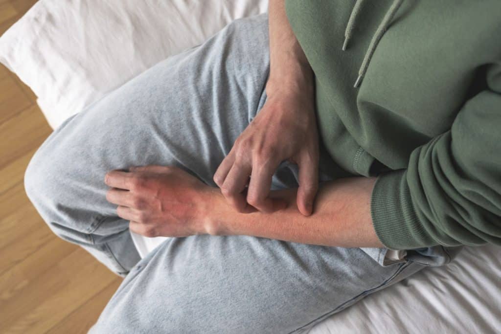 A person sits on a bed in a green hoodie and gray pants, scratching their red, irritated forearm—a common skin condition that may lead to skin cancer.