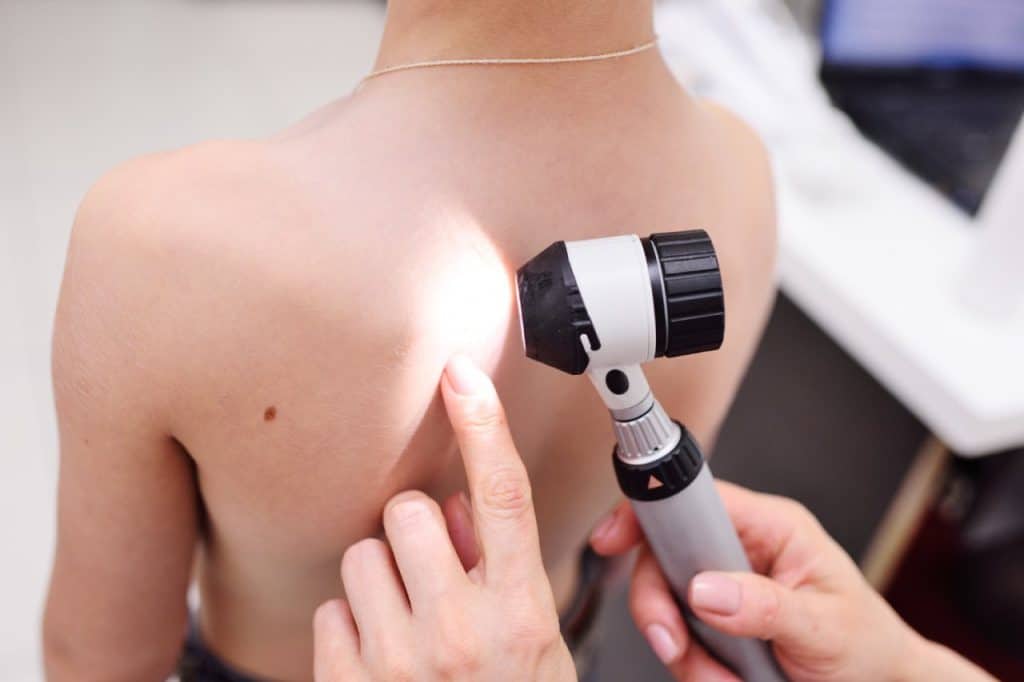 A doctor examines a mole on a child's back with a dermatoscope in a medical setting, checking for signs of skin cancer.