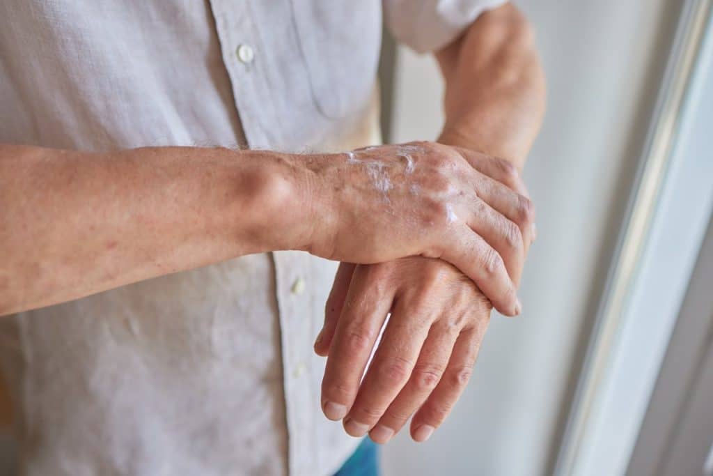 A person applies lotion to the back of their left hand using their right hand, wearing a light-colored shirt—demonstrating gentle aftercare following patient advice.