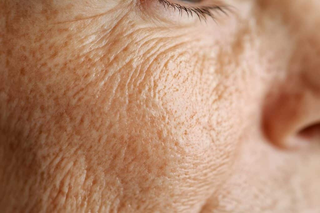 Close-up of an elderly person's face showing detailed skin texture, wrinkles, fine lines, and age spots near the eye and cheek—ideal for illustrating the effects of collagen remodelling on healthy skin.