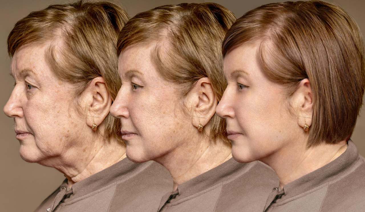Side-by-side portraits of a woman showing the evolution of skin through aging reversal effects, with visible signs of ageing and reduced wrinkles over three stages from left to right.