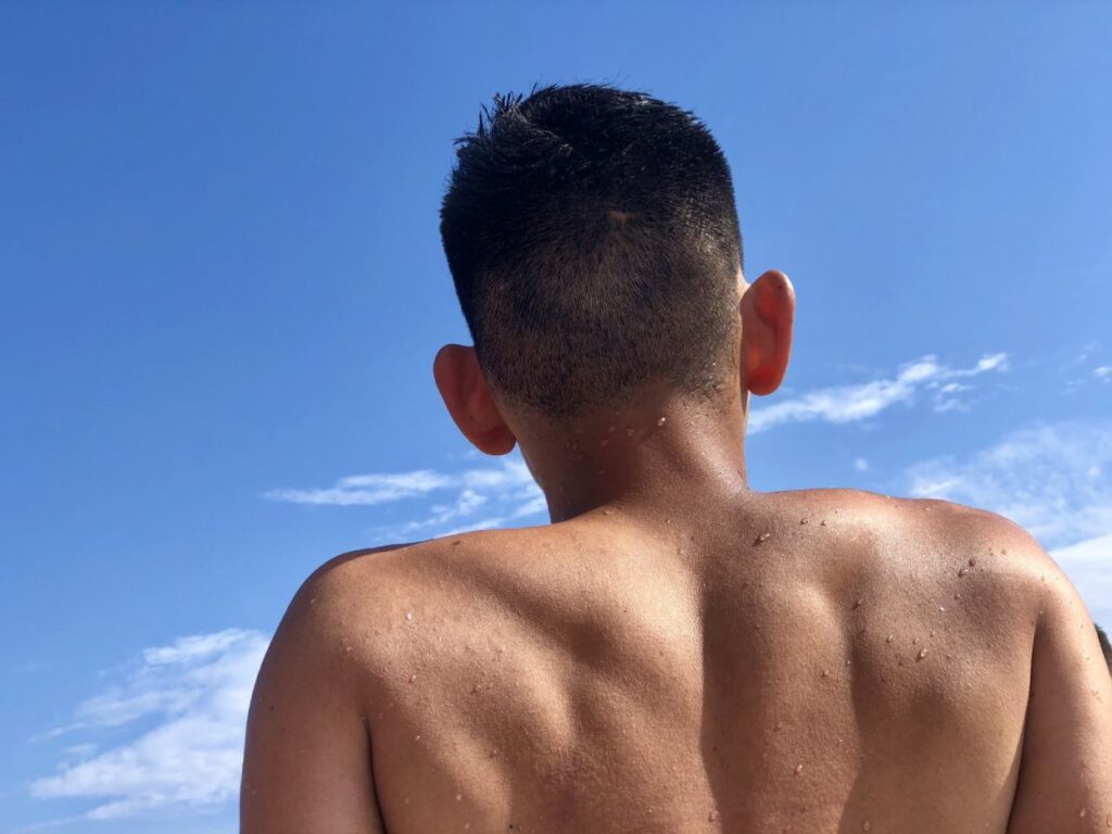 A person with short dark hair is seen from behind, shirtless, showcasing the unique contours of asian man with thick skin on the back comparing to skin thickness of face.